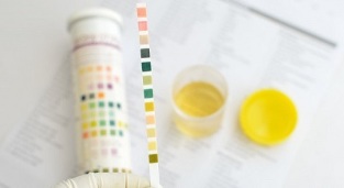 I can smoke before giving urine for analysis