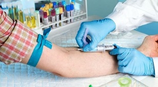 smoke and get a blood test from a vein