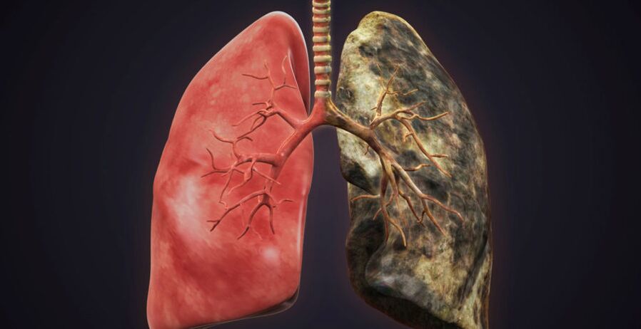 leave the lungs of smokers and the lungs of smokers